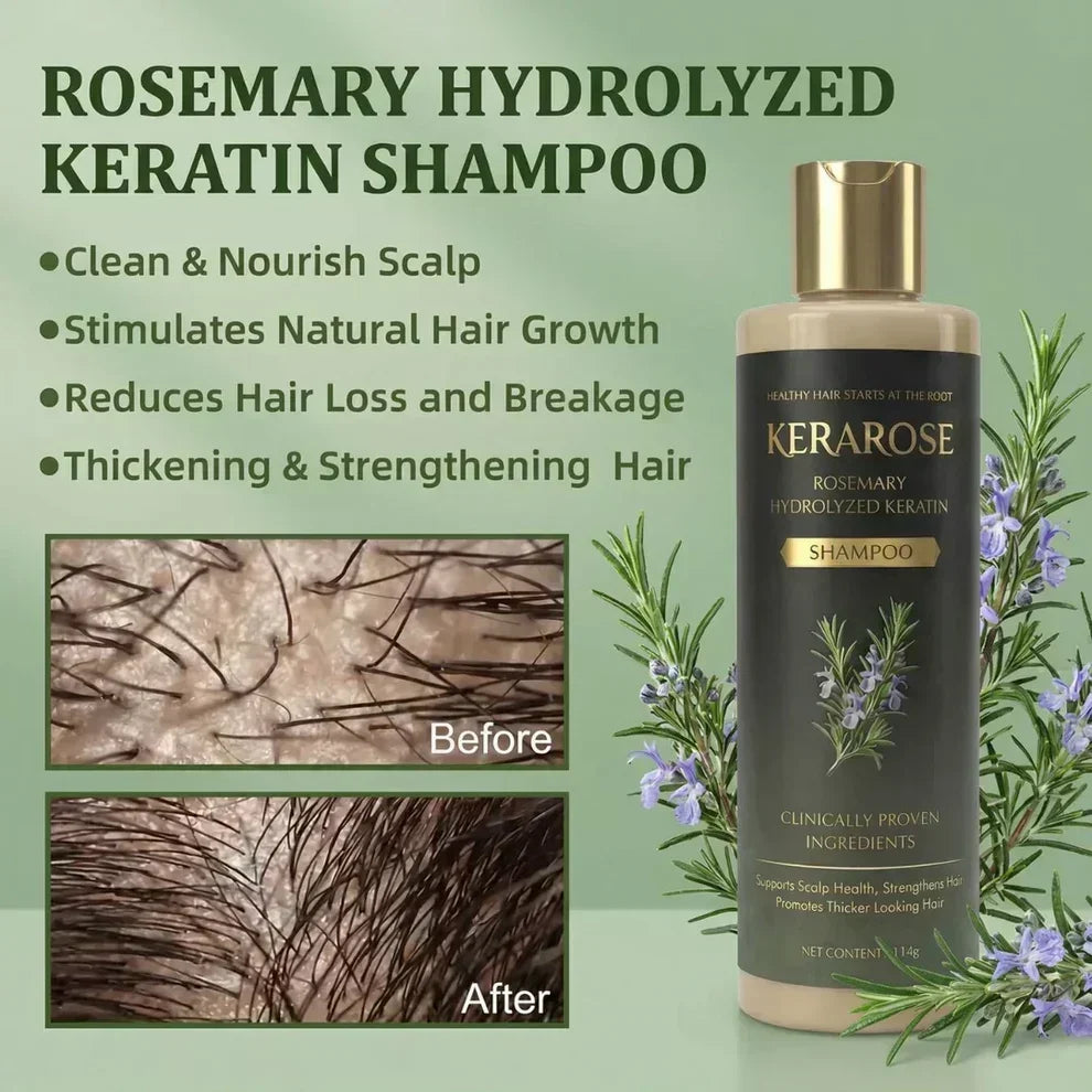 Rosemary + Keratin shampoo | Buy 1 Get 1 FREE! | Get 2 @ RS 599