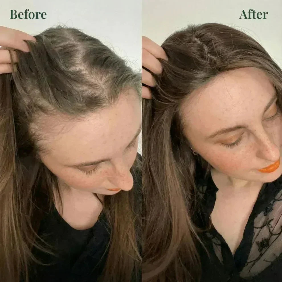 Rosemary + Keratin shampoo | Buy 1 Get 1 FREE! | Get 2 @ RS 599